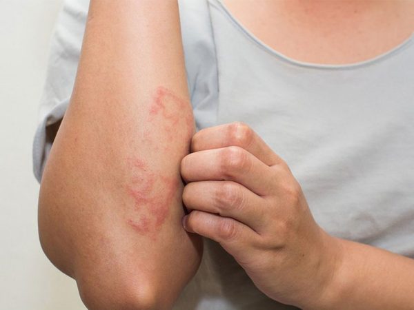 Những tác hại của việc sử dụng nước hoa giả là gì?